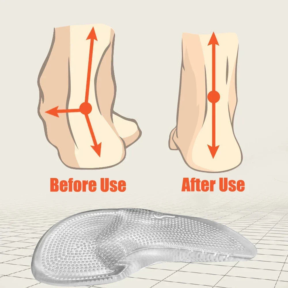Orthopedic Insoles | Firm Arch Support & Shock-Absorbing Silicone Gel | For Flat Feet & Plantar Fasciitis